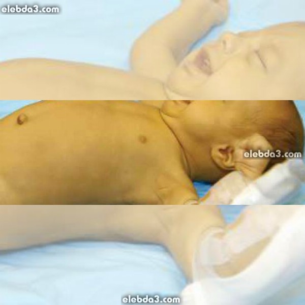 مقال: أعراض و علامات مرض الطفل المولود حديث الولادة | أمراض الطفل حديث الولادة 
