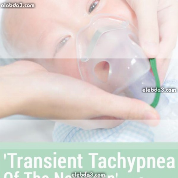 مقال: الزلة التنفسية العابرة عند الطفل حديث الولادة | أمراض الطفل حديث الولادة 