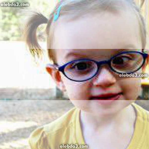 مقال: الغمش أو كسل العين عند الاطفال و الرضع | امراض العيون عند الاطفال 