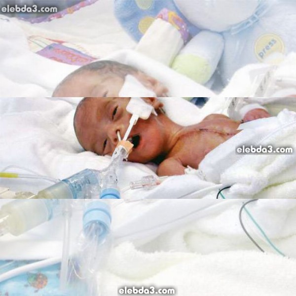 مقال: موت و وفاة الطفل حديث الولادة | أمراض الطفل حديث الولادة 