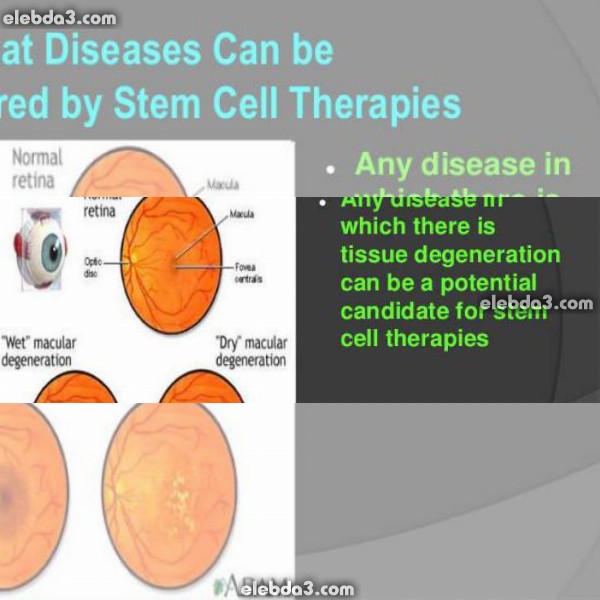 مقال: الأمراض التي يمكن علاجها بالخلايا الجذعية | امراض الدم عند الاطفال 