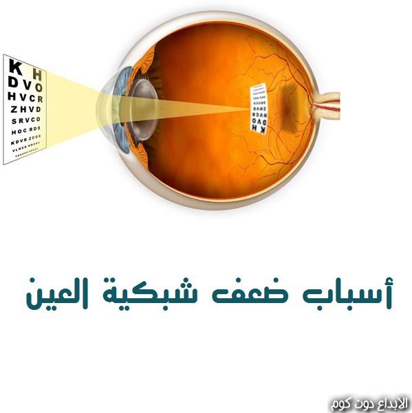 مقال: أسباب ضعف شبكية العين | امراض العيون
