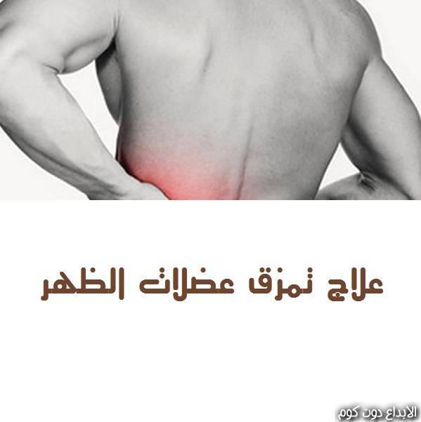 مقال: علاج تمزق عضلات الظهر | امراض العظام