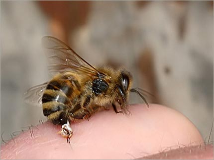 لدغة النحل لعلاج التهاب المفاصل