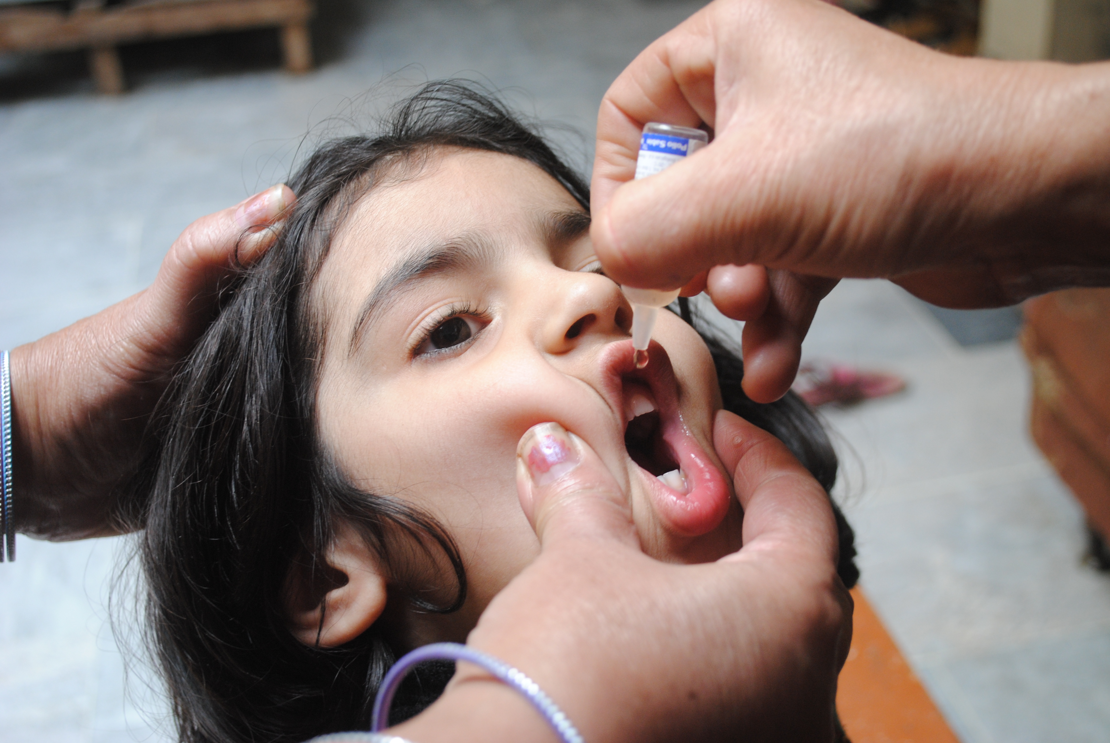لقاح شلل الأطفال الفموي