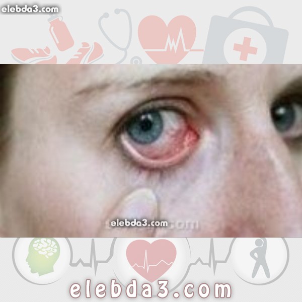 مقال: أعراض مرض شبكية العين | امراض العيون